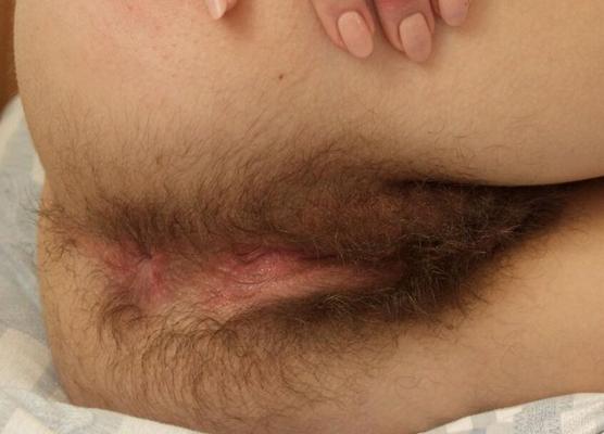 hairy
