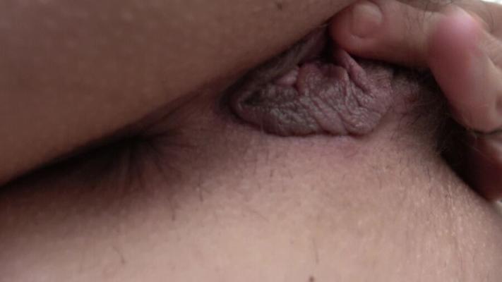 Detalhes dos furos
