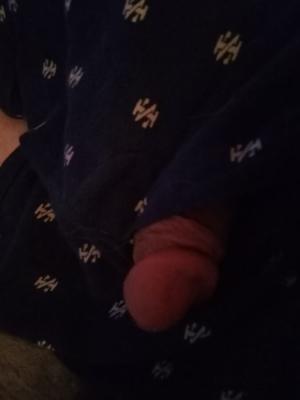 Mi esposo necesita que le quiten el pipicito, ¿cómo lo hago?
