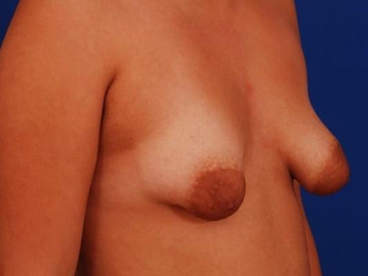 Des seins разные...