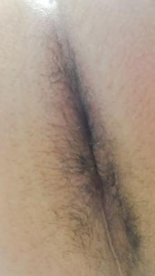 mi agujero