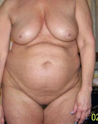 Ventre plus gros