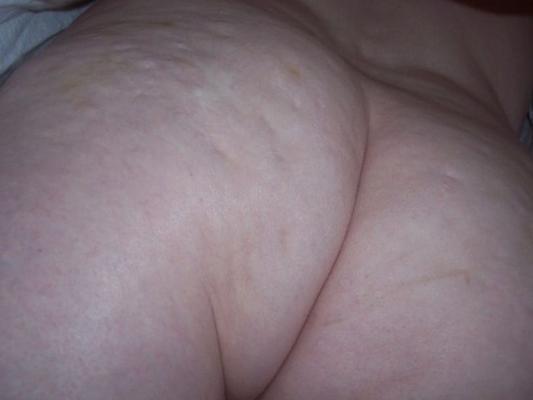 Filles avec de la cellulite