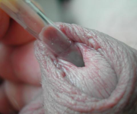 Meu micropênis