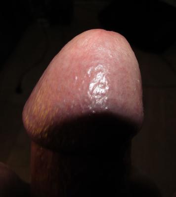 角質弱虫