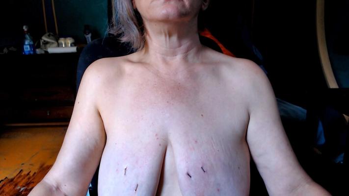 20240912 Staple Punishment