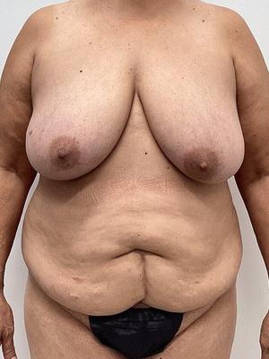 CORPS NATUREL