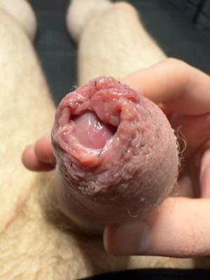 Embarrasing Photos