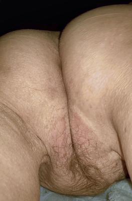 Bichano