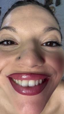 Gemischte Fotos