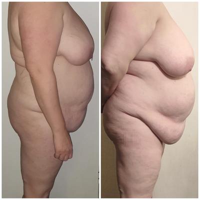 BBW Frau Comparrison
