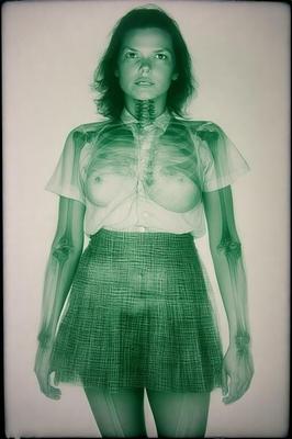 X Ray