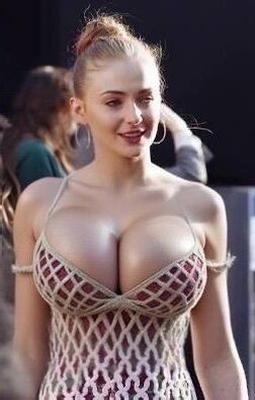 Расширение груди знаменитостей