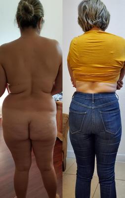 Topón desnudo vestido
